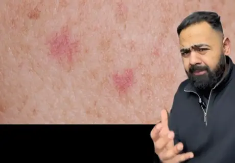 It can take on many different forms.  Instagram/ @drkaranrajan