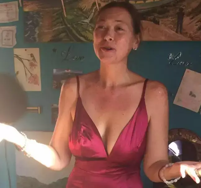 Amy Carlson before taking so much colloidal silver that she turned her face blue.