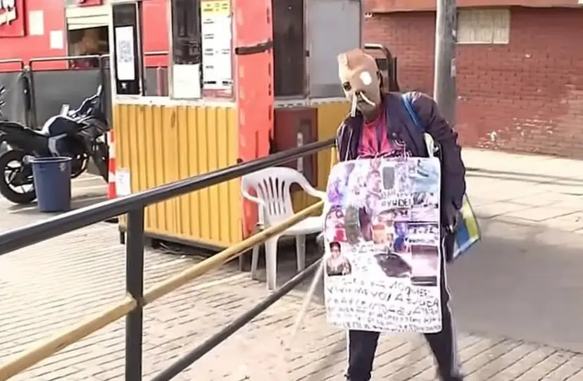 Maria Consuelo Cordoba suffered an acid attack 26 years ago (CityTV)