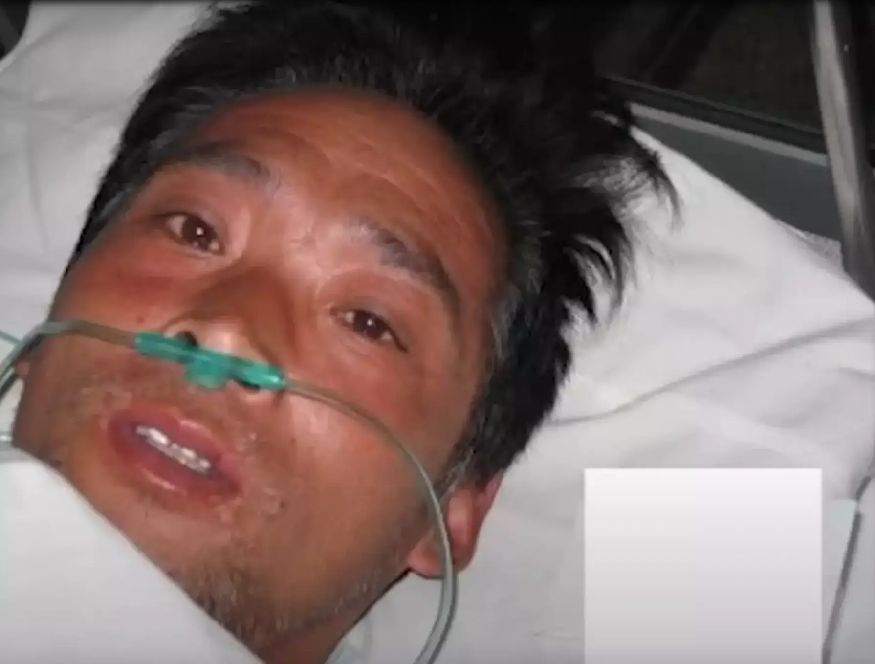 Ouchi absorbed three times the fatal dose of radiation, instantly (Peaked Interest/YouTube)