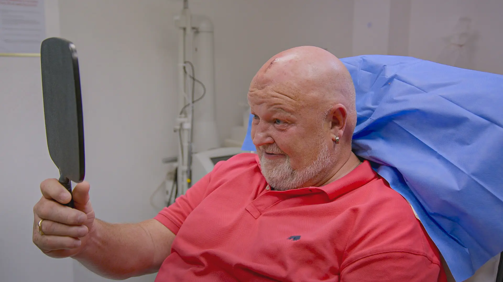 Clyde was loving his new look (The Bad Skin Clinic/Discovery+)