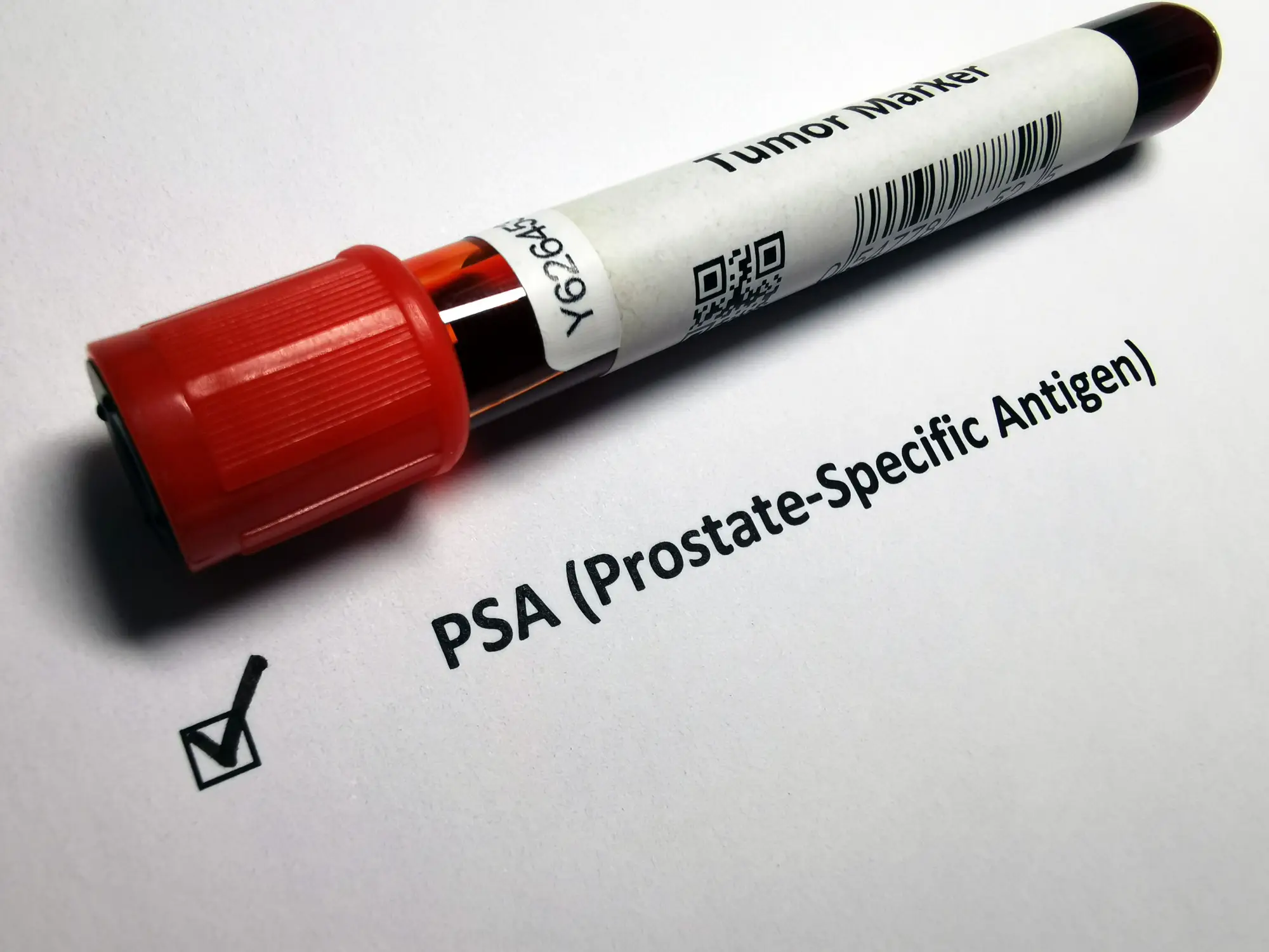 The UKNSC is set to advise against wide scale screening with PSA tests (Getty Stock Images)