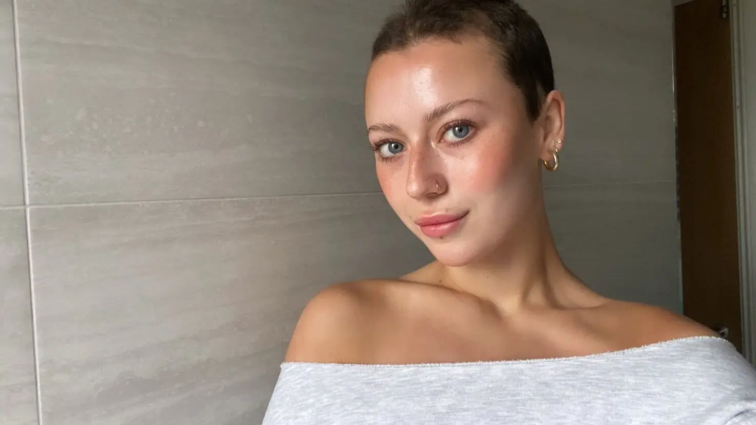 Lauren has opened up about the reality of receiving an alopecia areata diagnosis at 23 (Supplied)