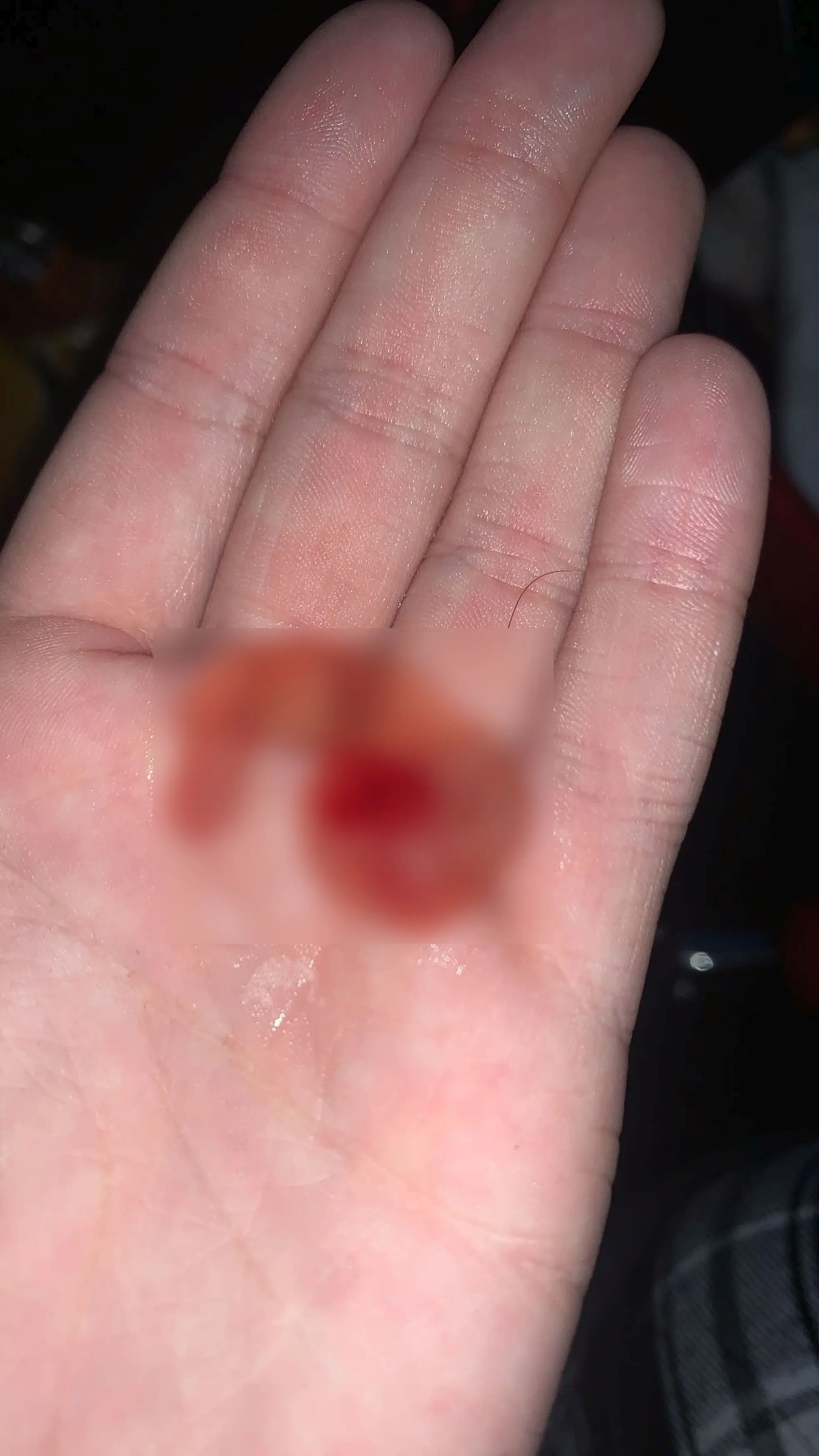Paige urinated a chunk of her own bladder due to the damage done by ketamine (Kennedy News and Media)