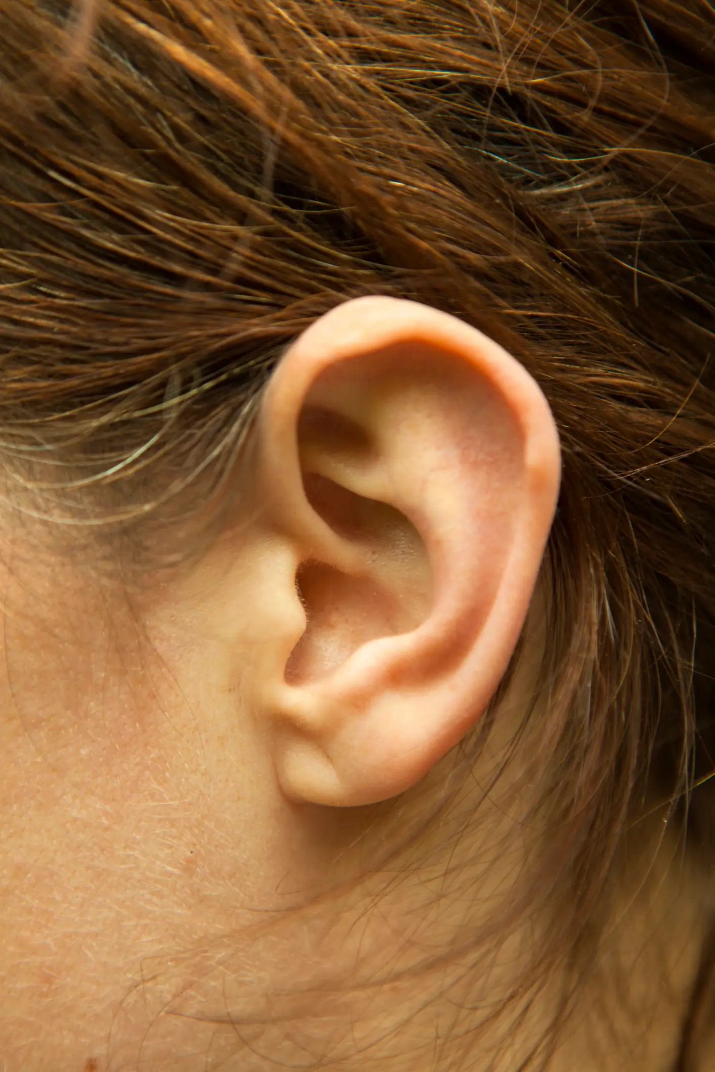 The crease usually goes from the tragus and down towards the far side of the earlobe (Getty Images/Magmos)
