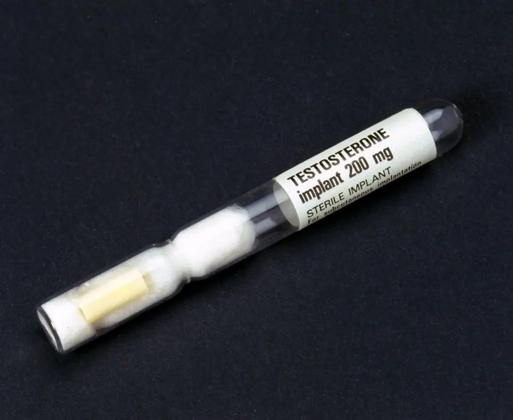 The doctor warned taking steroids could lessen your lifespan, worsen your mood and drop your health in many other ways (SSPL/Getty Images)