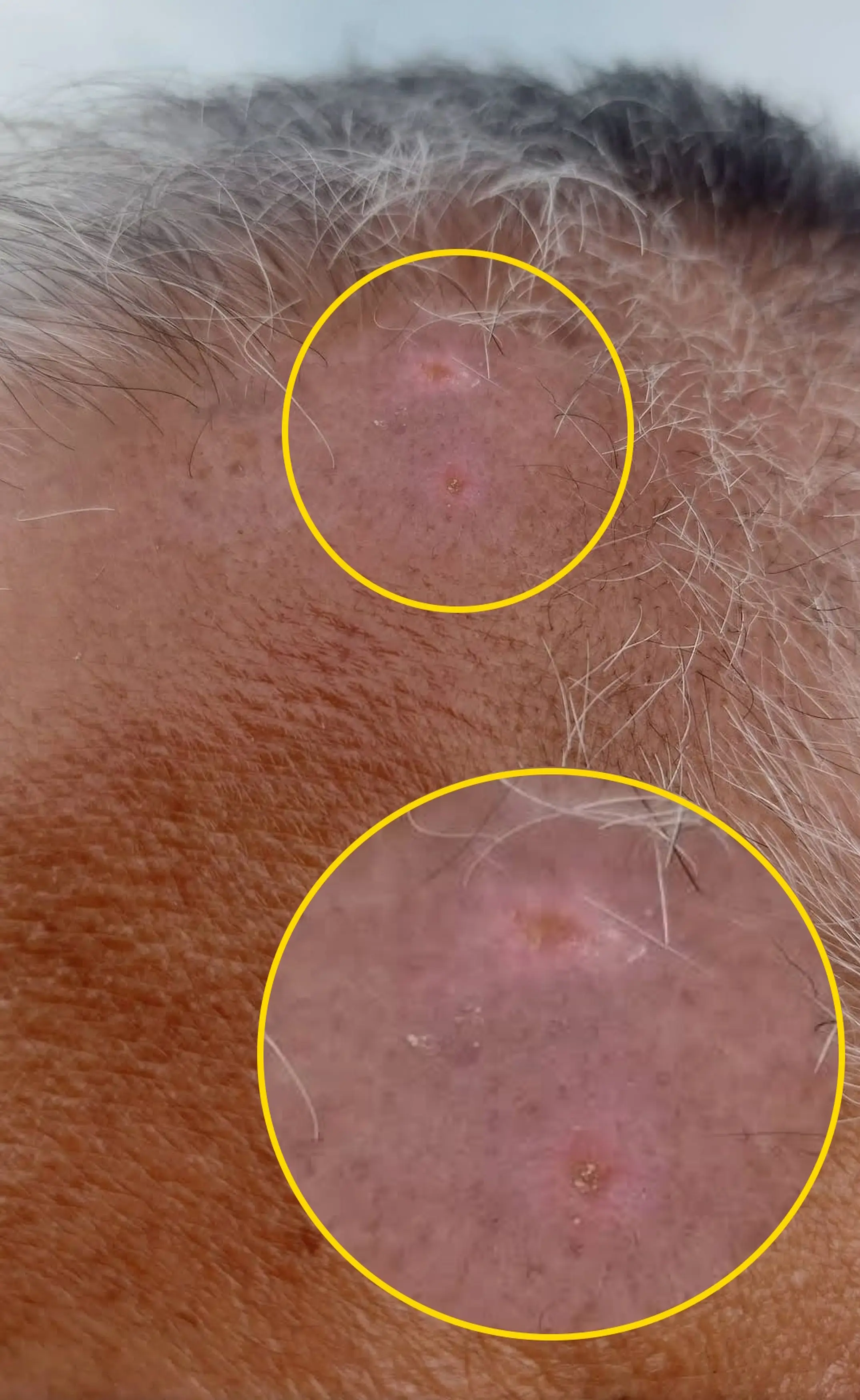 The marks really do look like fangs, don't they?