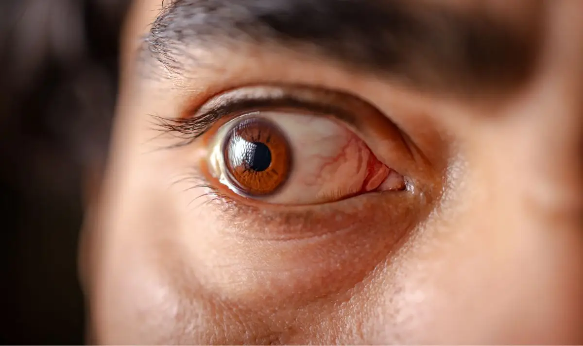 Those with AMD can now claim PIP. (Getty stock image)