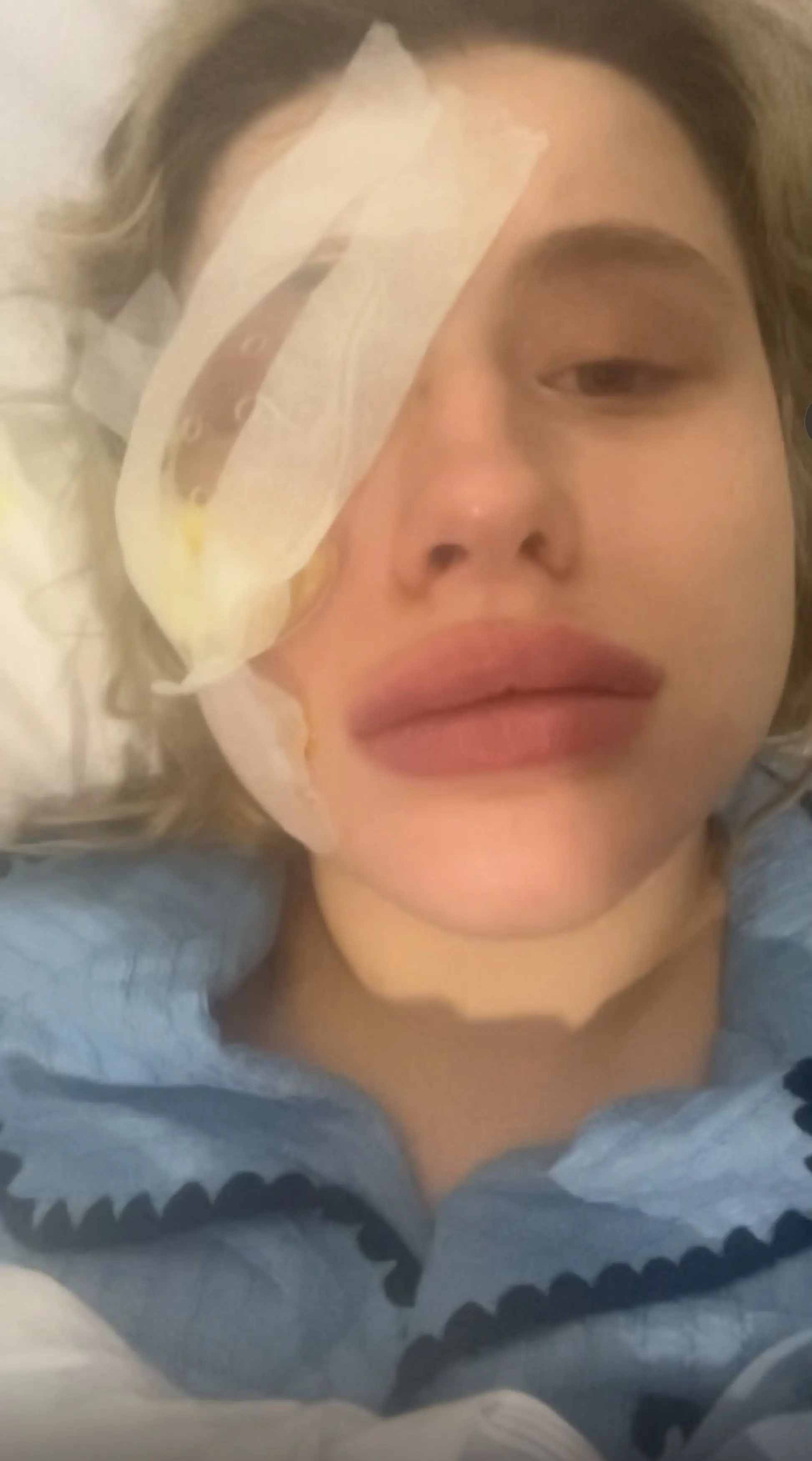 The teen is having her eye removed in June (Kennedy News and Media)