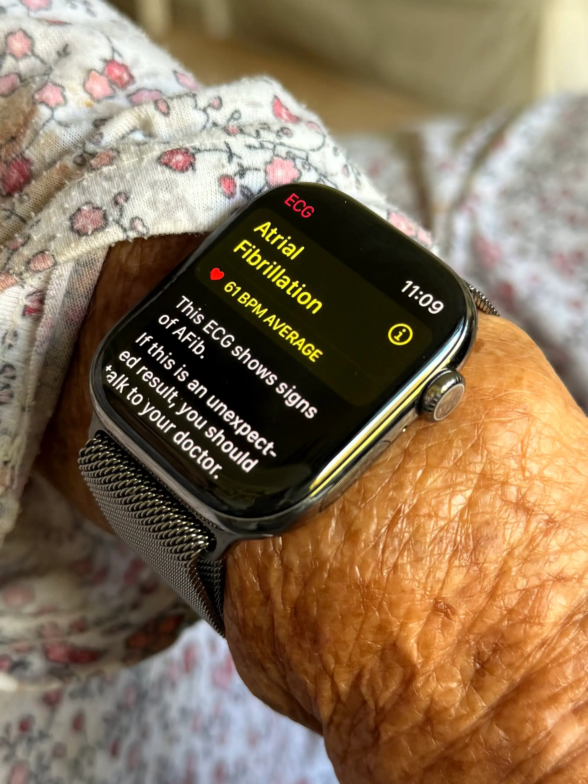 The watch detected her atrial fibrillation (X/@NikiasMolina)