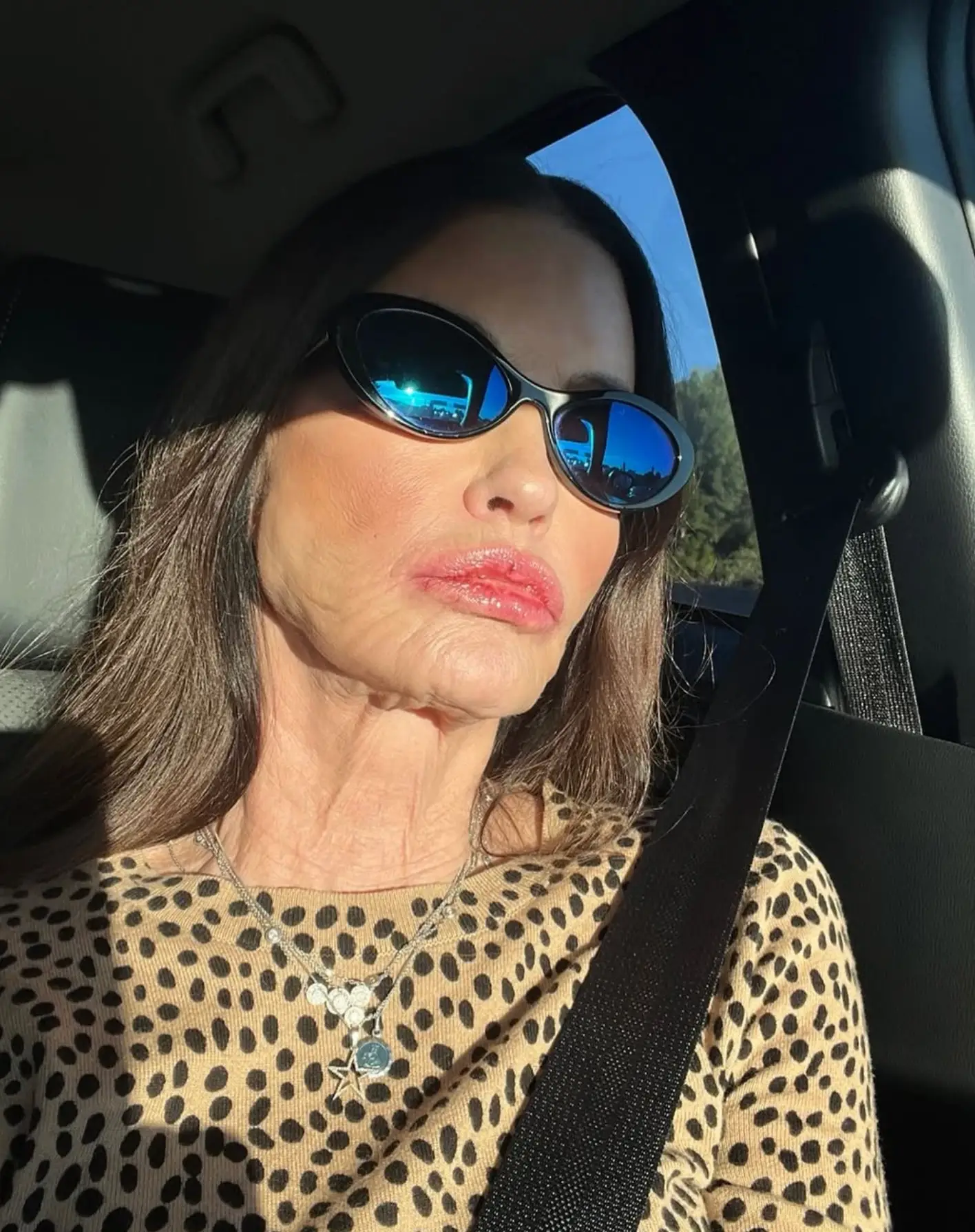 She claims doctors cannot correct her scars (Janicedickinson/Instagram)