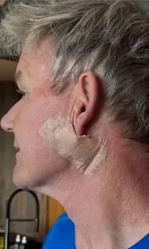 Gordon Ramsay shared a health update on social media (Instagram/@gordongram)