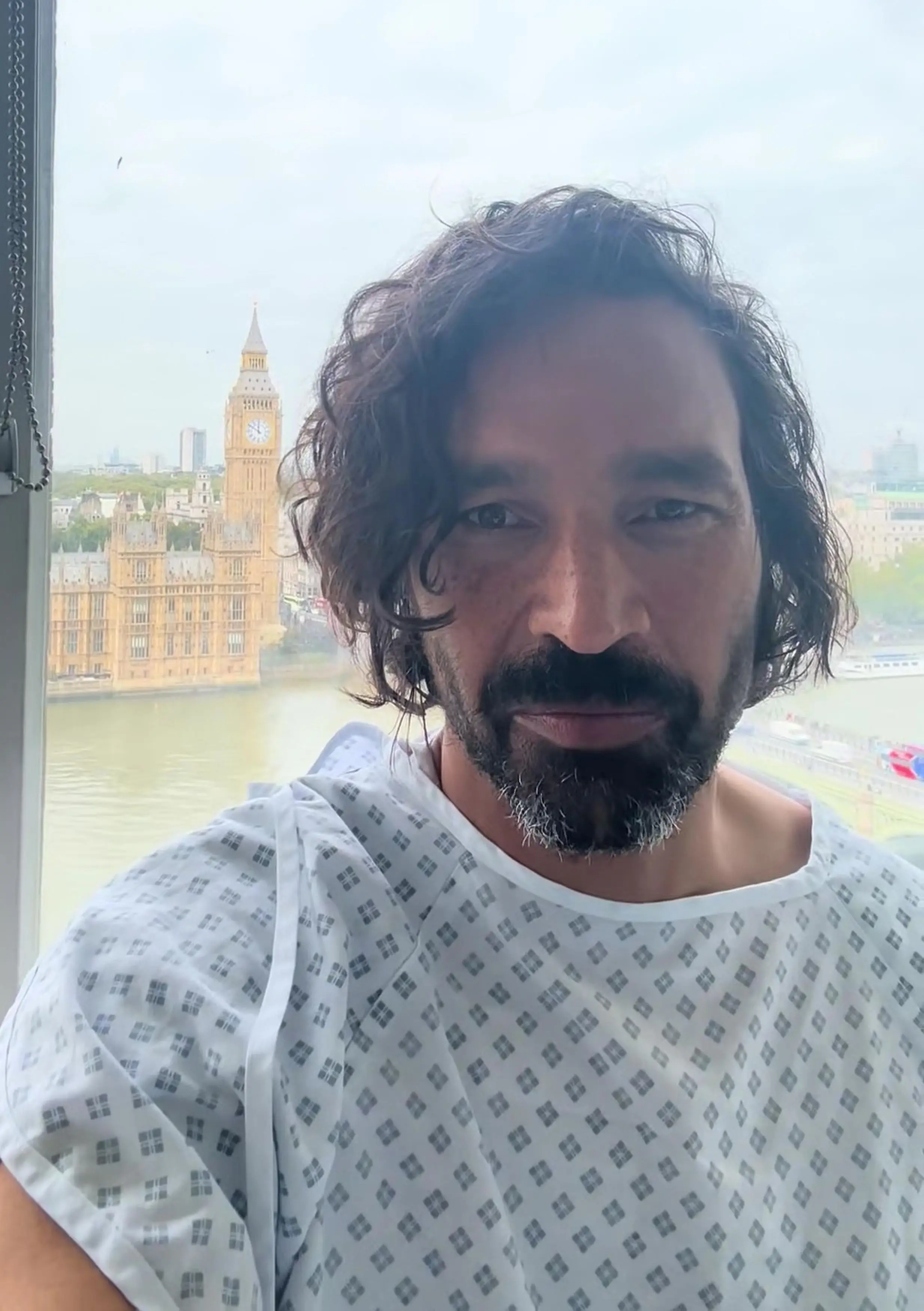 Dan had to undergo half a dozen surgeries after the stray attacked him (Kennedy News and Media)