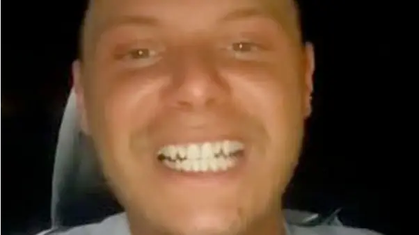 Lad Who Splashes £400 On Clip-In Veneers Is Shocked With Results