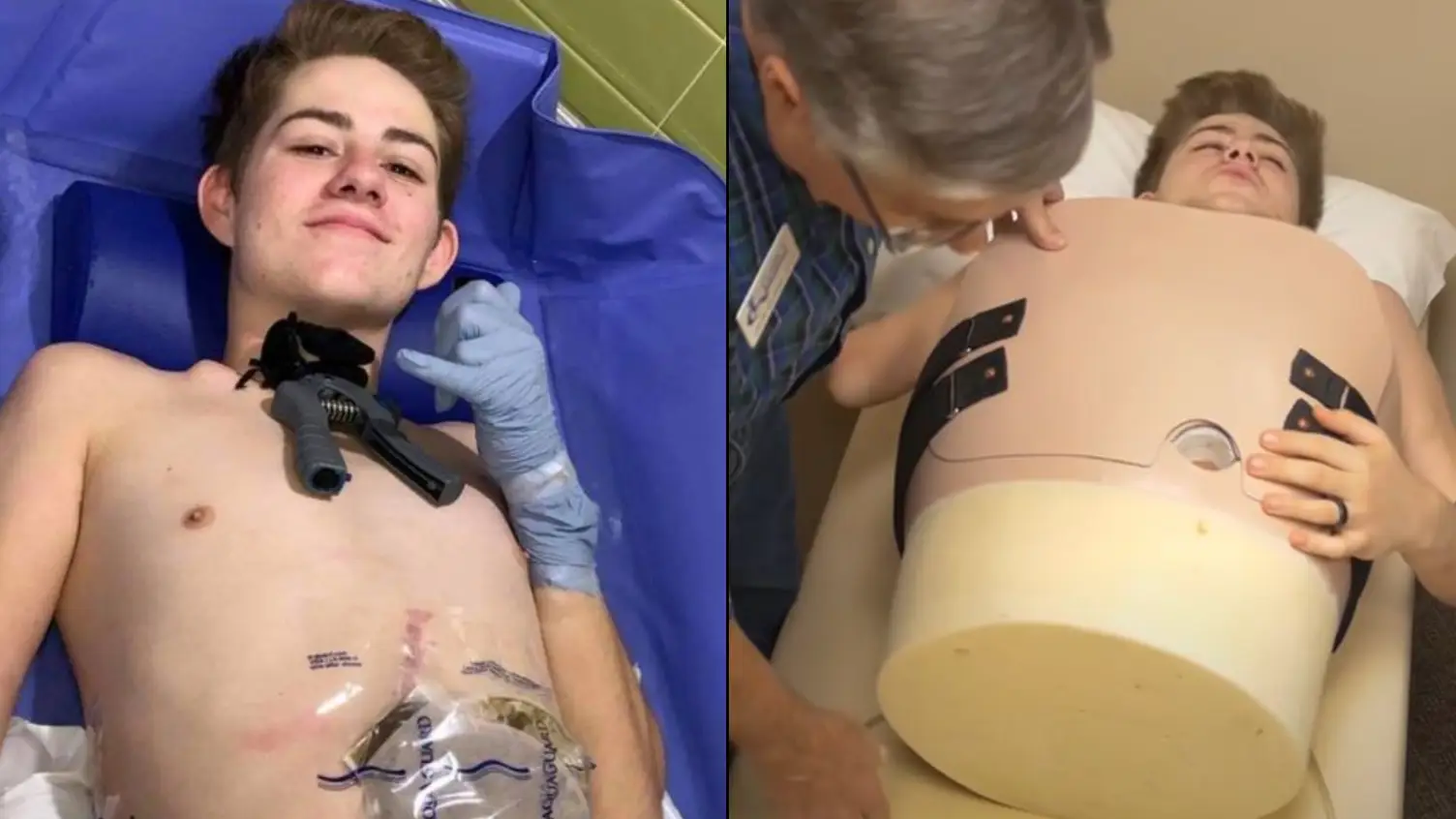 Man who was cut in half by forklift explains how he 'poops, pees and farts'