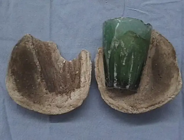 Glass tumbler and bladder stone.