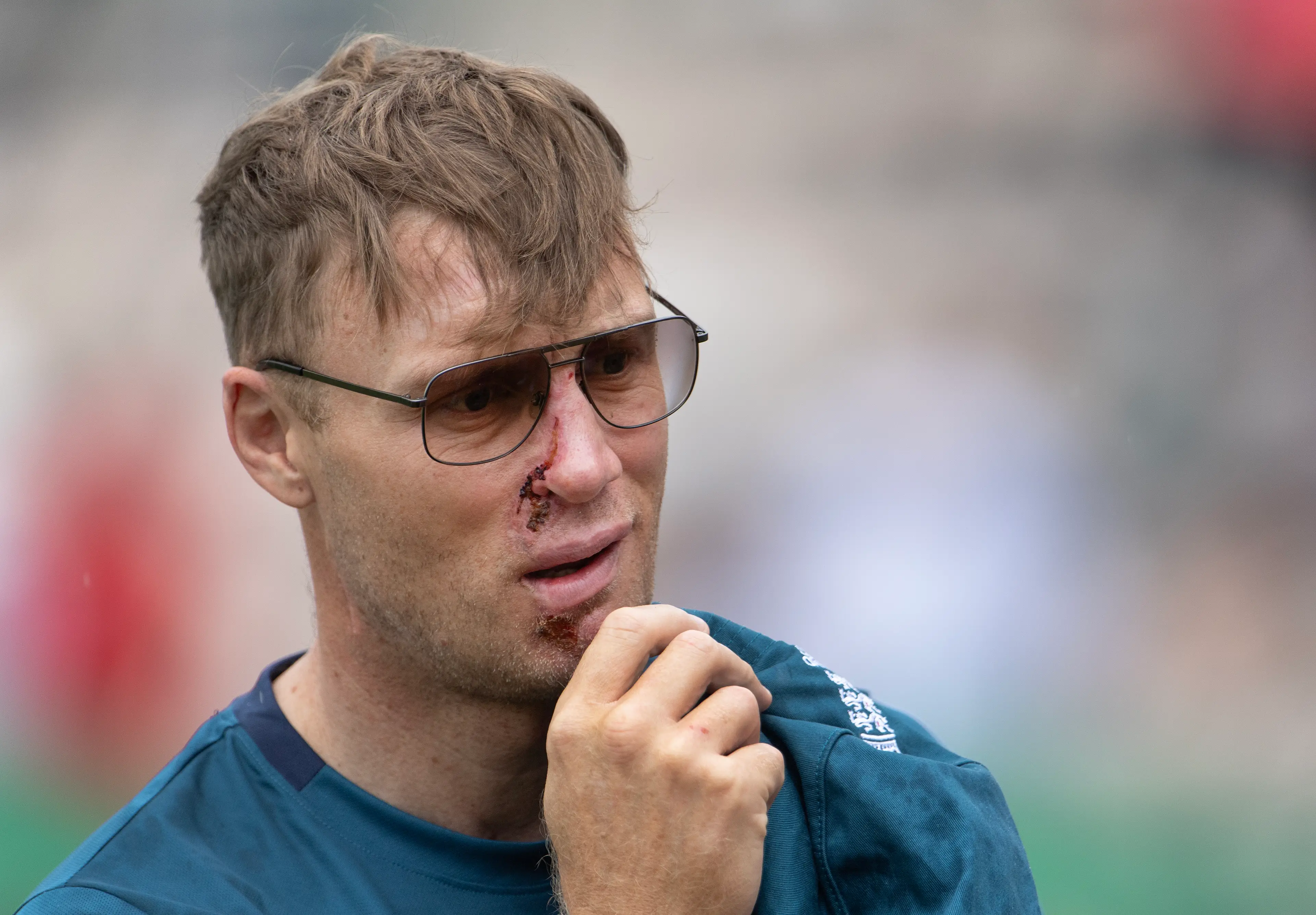 Freddie Flintoff was left with severe facial and rib injuries following the crash (Visionhaus/Getty Images)