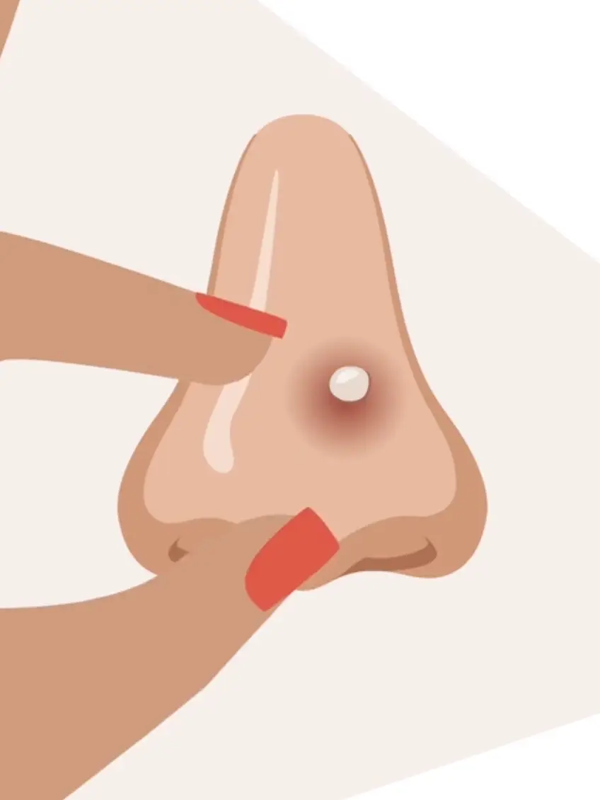 You may want to leave those spots alone (TikTok/@Cleveland Clinic)