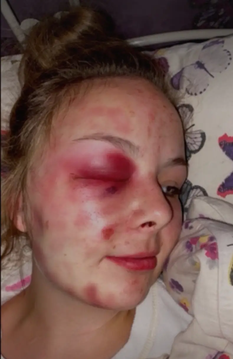 The injuries are believed to be self inflicted (BBC)