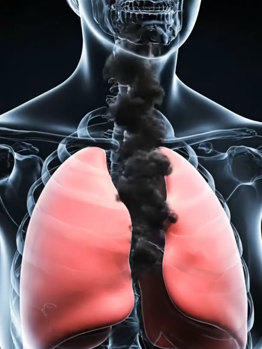 Each cigarette you smoke inflicts further damage on your lungs (YouTube/Health Cartoon Corner)