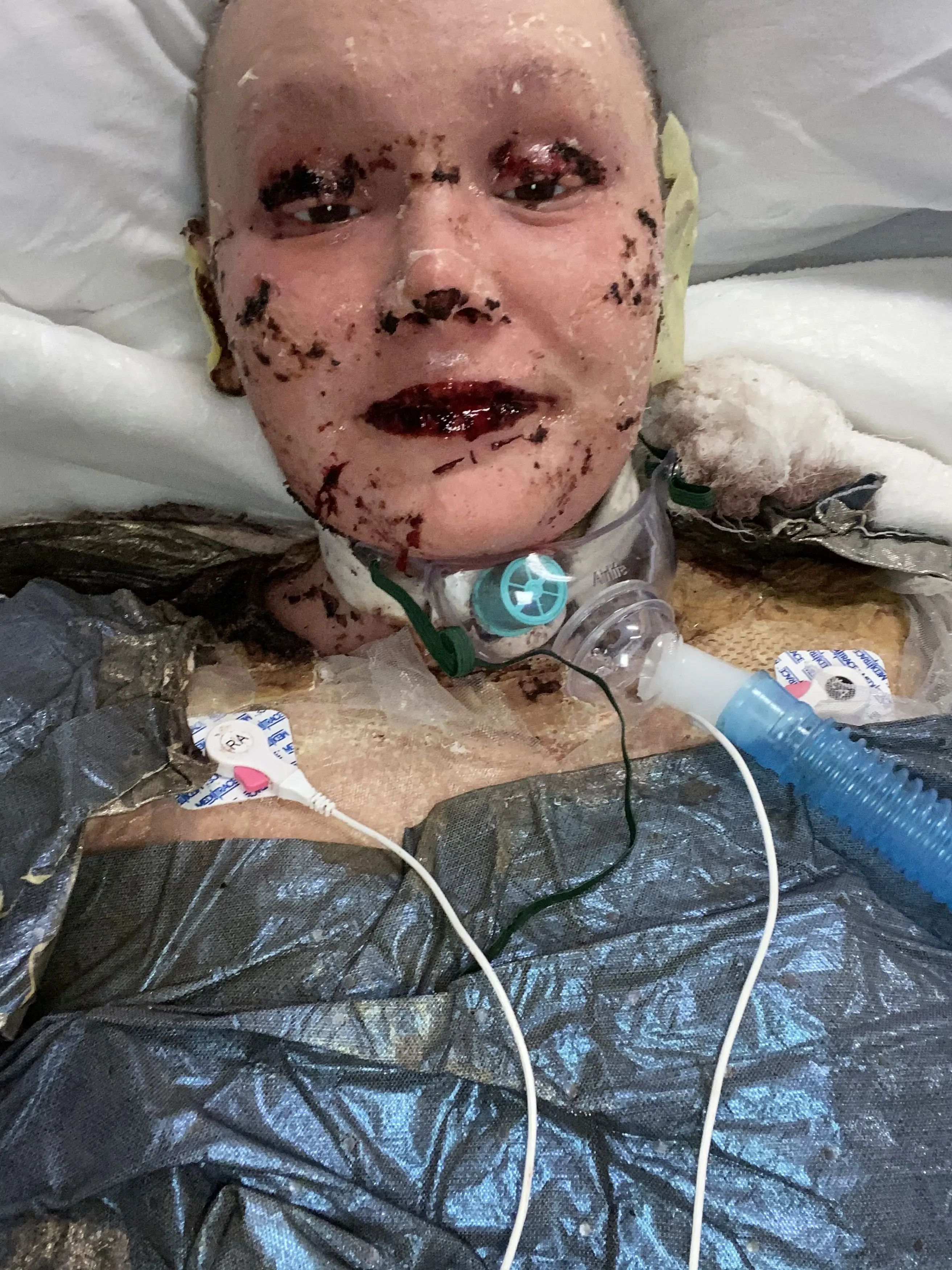 Aleshia said ibuprofen was her 'go-to med' (Kennedy News and Media)