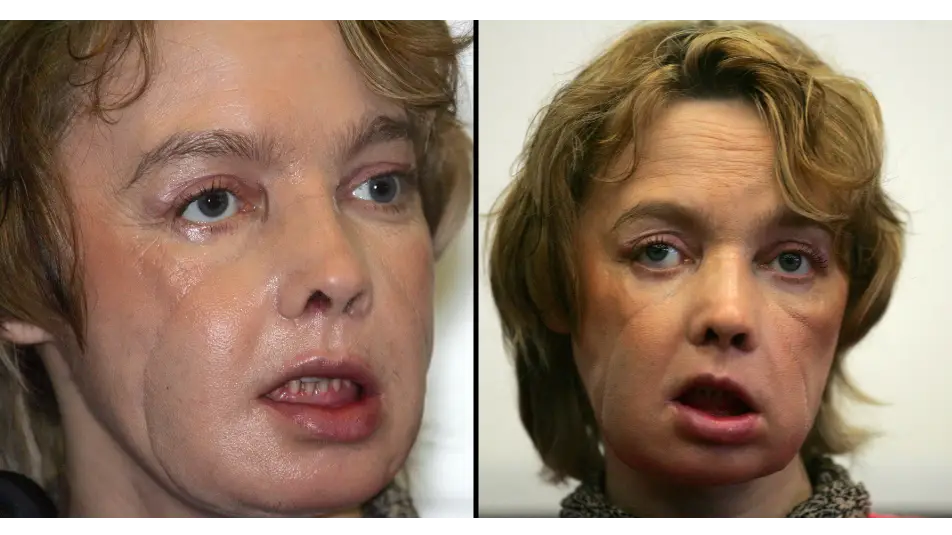 DENIS CHARLET/AFP/Franck CRUSIAUX/Gamma-Rapho via Getty Images