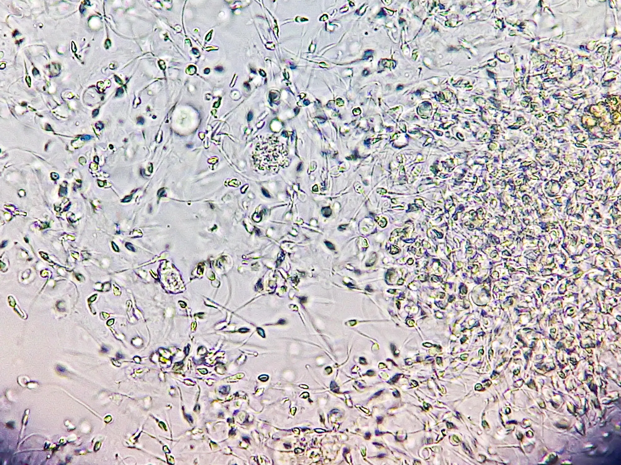 Dead sperm cells are eventually broken down and flushed out (Getty Stock Photo)