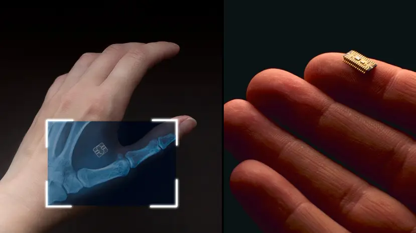 Company Claims To Be First To Sell Contactless Bank Card Chips Implanted Into Humans