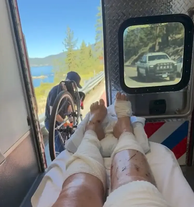 Swimming instructor Lynette Bellin needed dozens of stitches (KCRA)