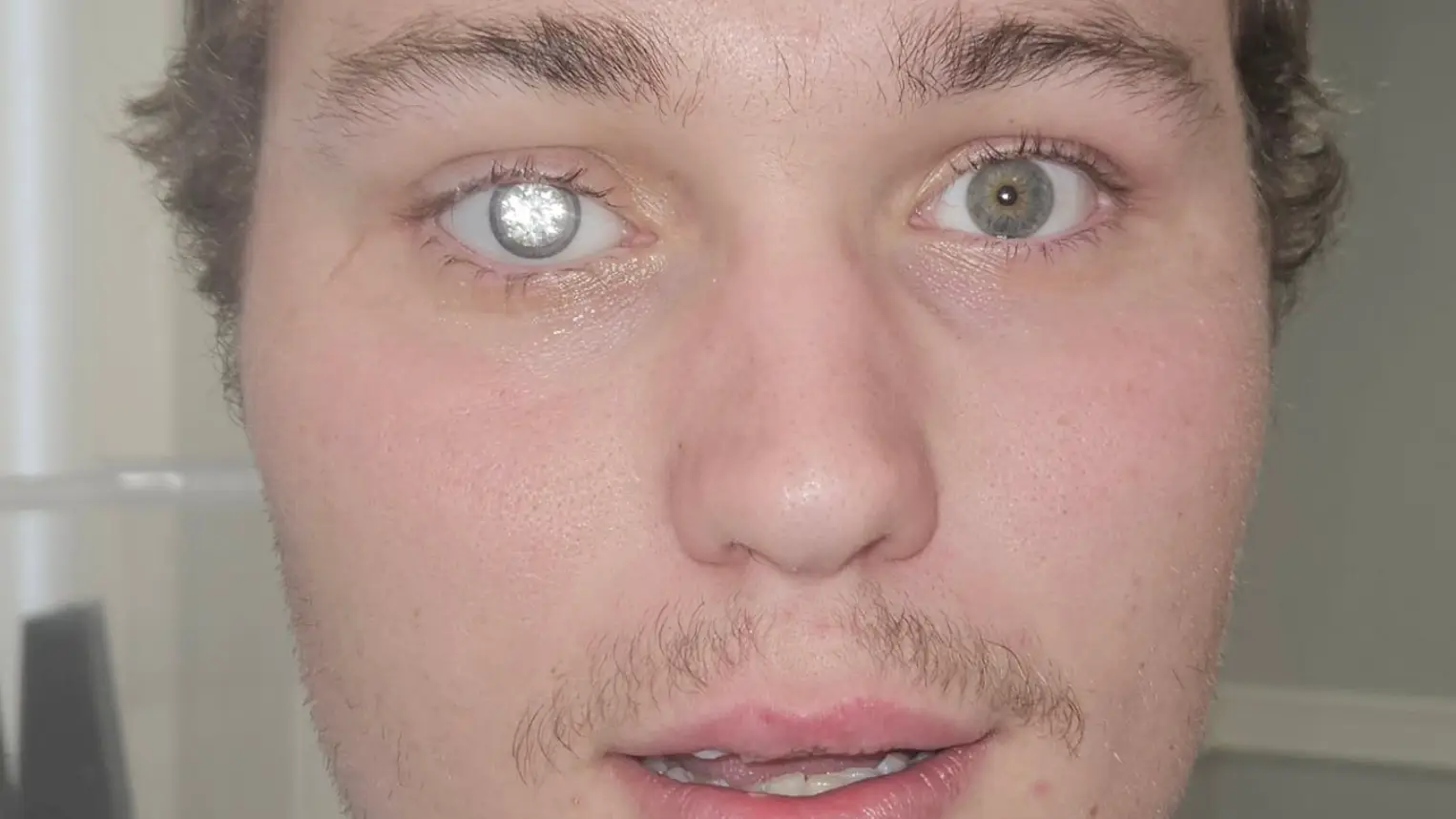 (Instagram/artificialeyesbyjohnimm)