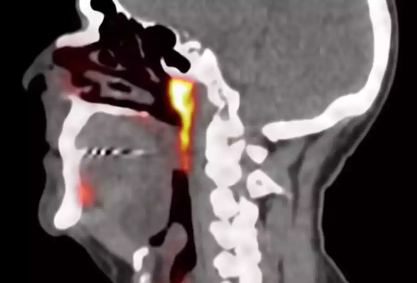 The new organ was only discovered in 2020, and it was right under our noses this whole time. (YouTube/Antoni Van Leeuwenhoek)