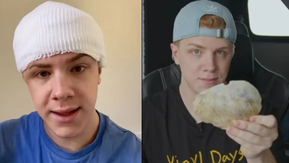 Mystery as man left with half a skull has no idea what happened to him