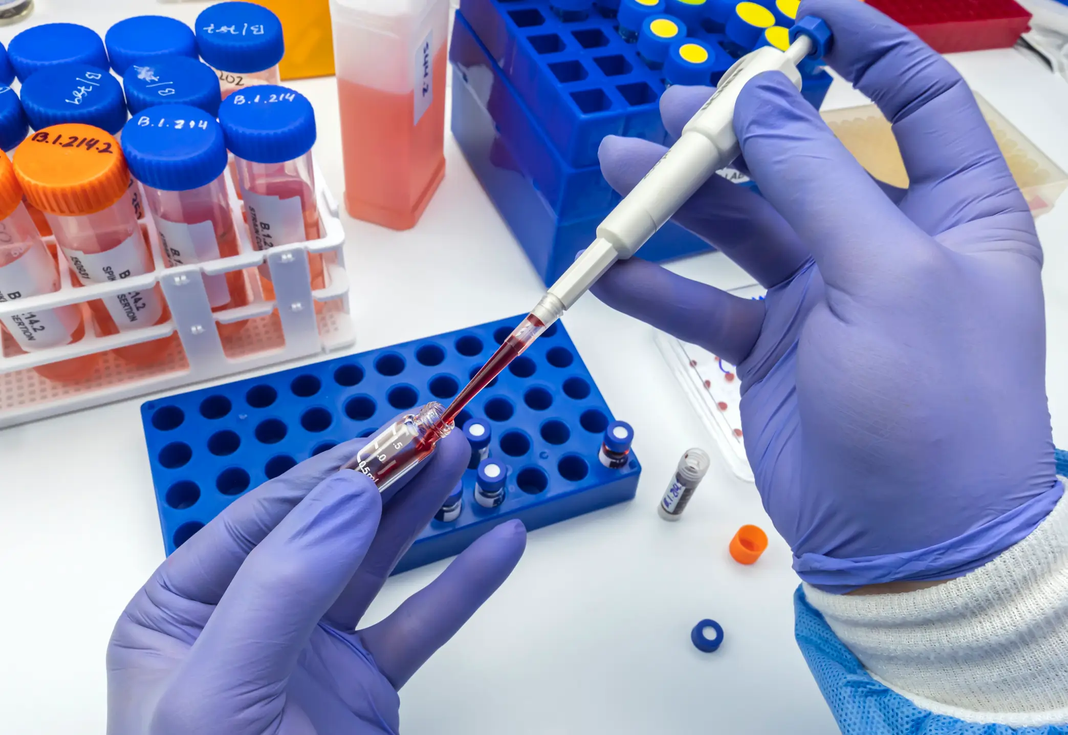 The test measures the level of PSA in your blood (Getty Stock Photo)