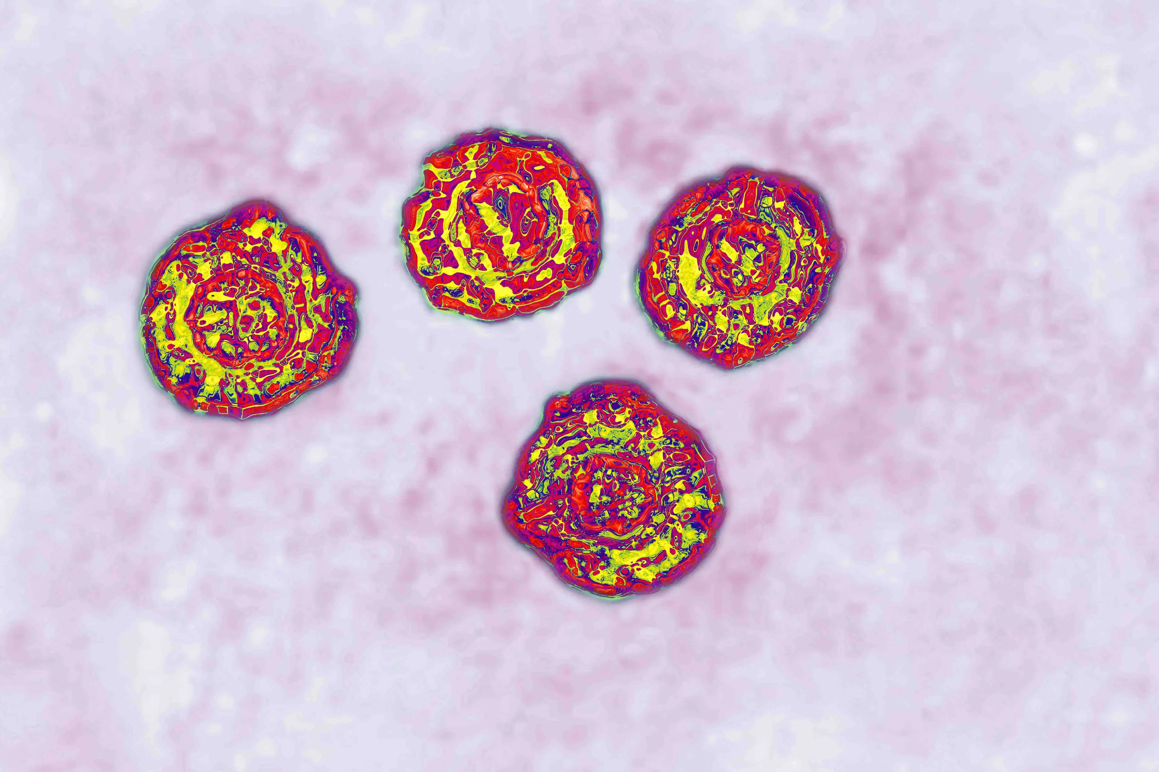 Those who inject steroids could be at risk of having Hepatitis C  (CAVALLINI JAMES/BSIP/Universal Images Group via Getty Images) 