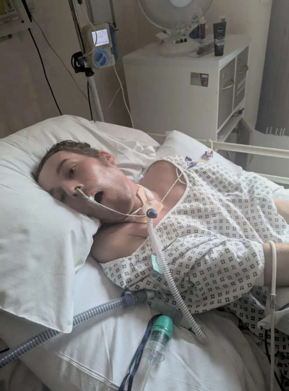 He is now only able to communicate by blinking and shrugging (SWNS)