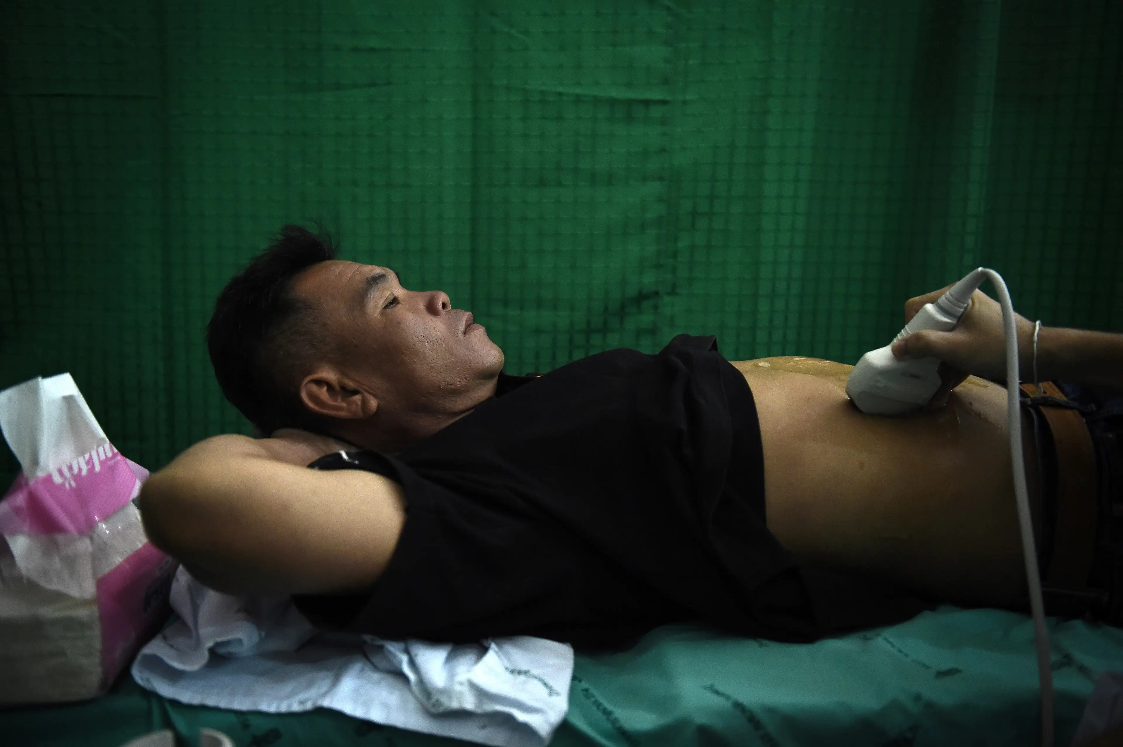 A man pictured in 2017 while undergoing an ultrasound to see if he has been infected with the parasites (LILLIAN SUWANRUMPHA/AFP via Getty Images)