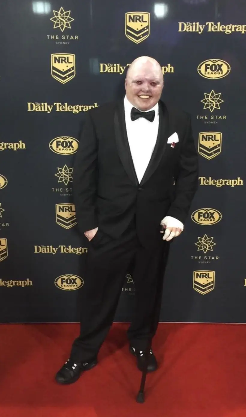 But Dean has continued to defy the odds and is still going strong (Instagram/@itsdeanclifford)