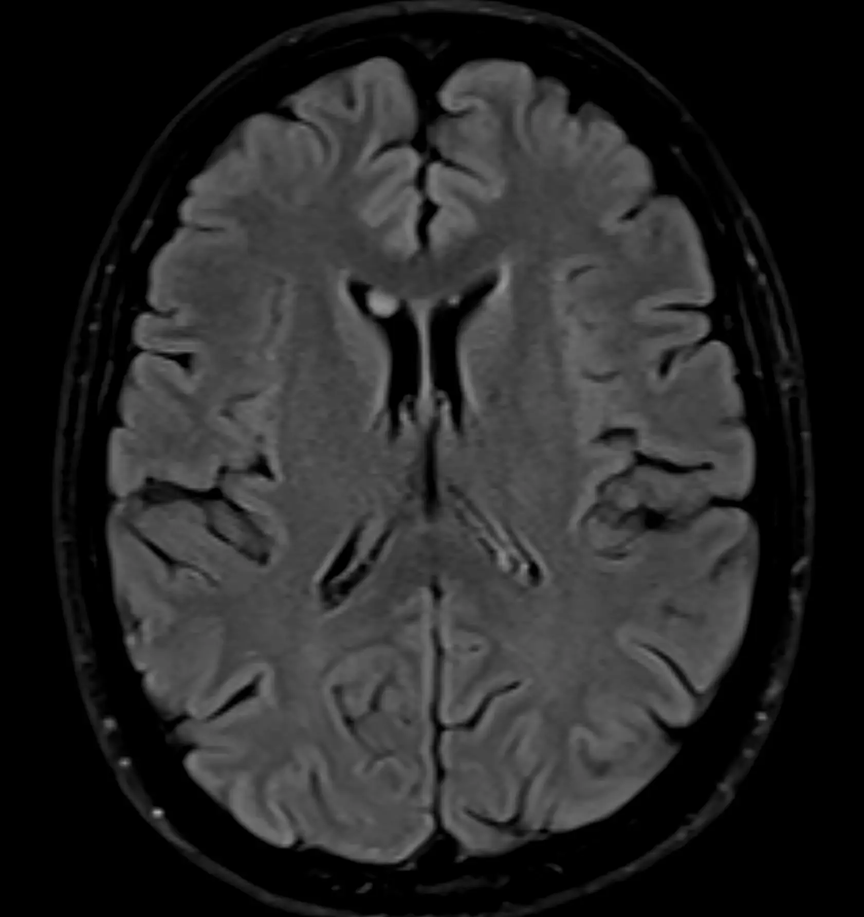 Scientists found that shocking a certain section of the brain caused the woman to sense someone standing next to her. (Getty Stock Photo)