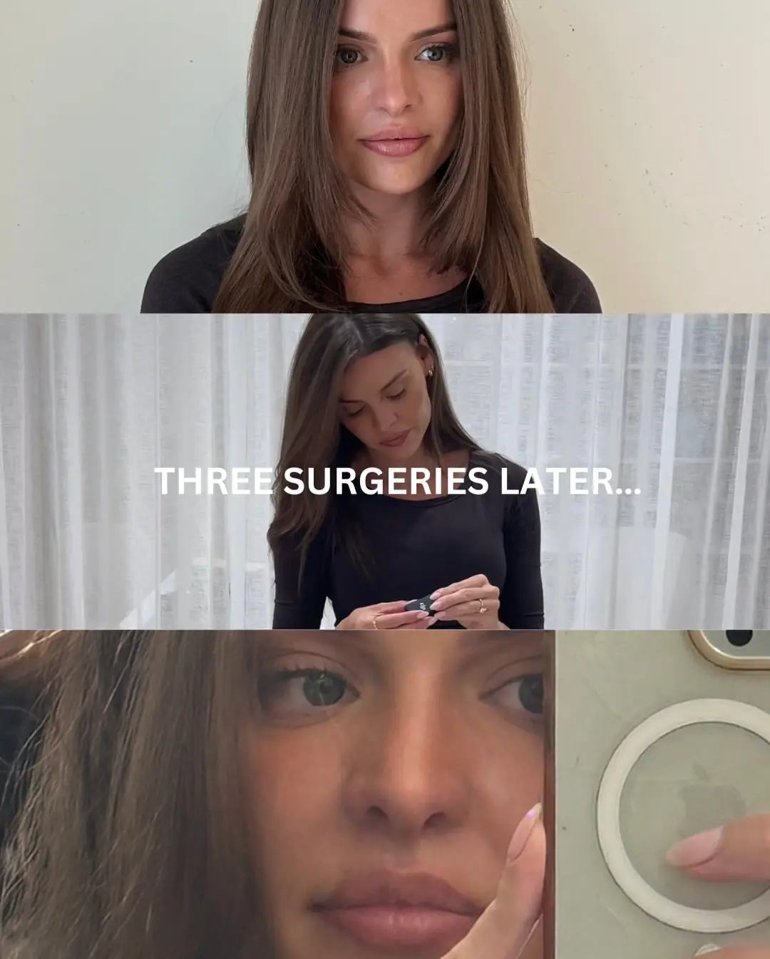 What Kim's nose looks like now (Instagram/@kimhartnett_)