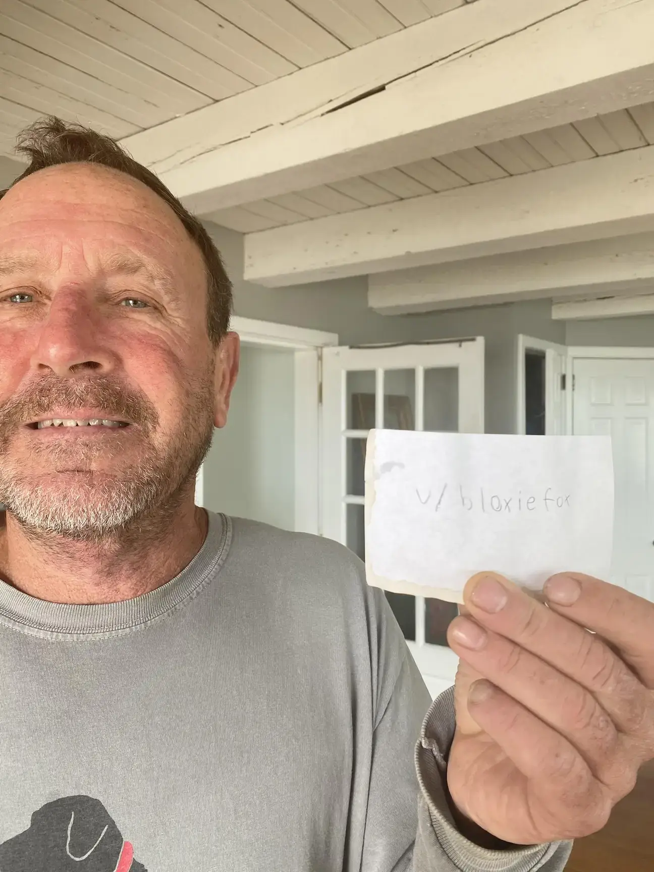 Amazingly, he lived to tell the tale.