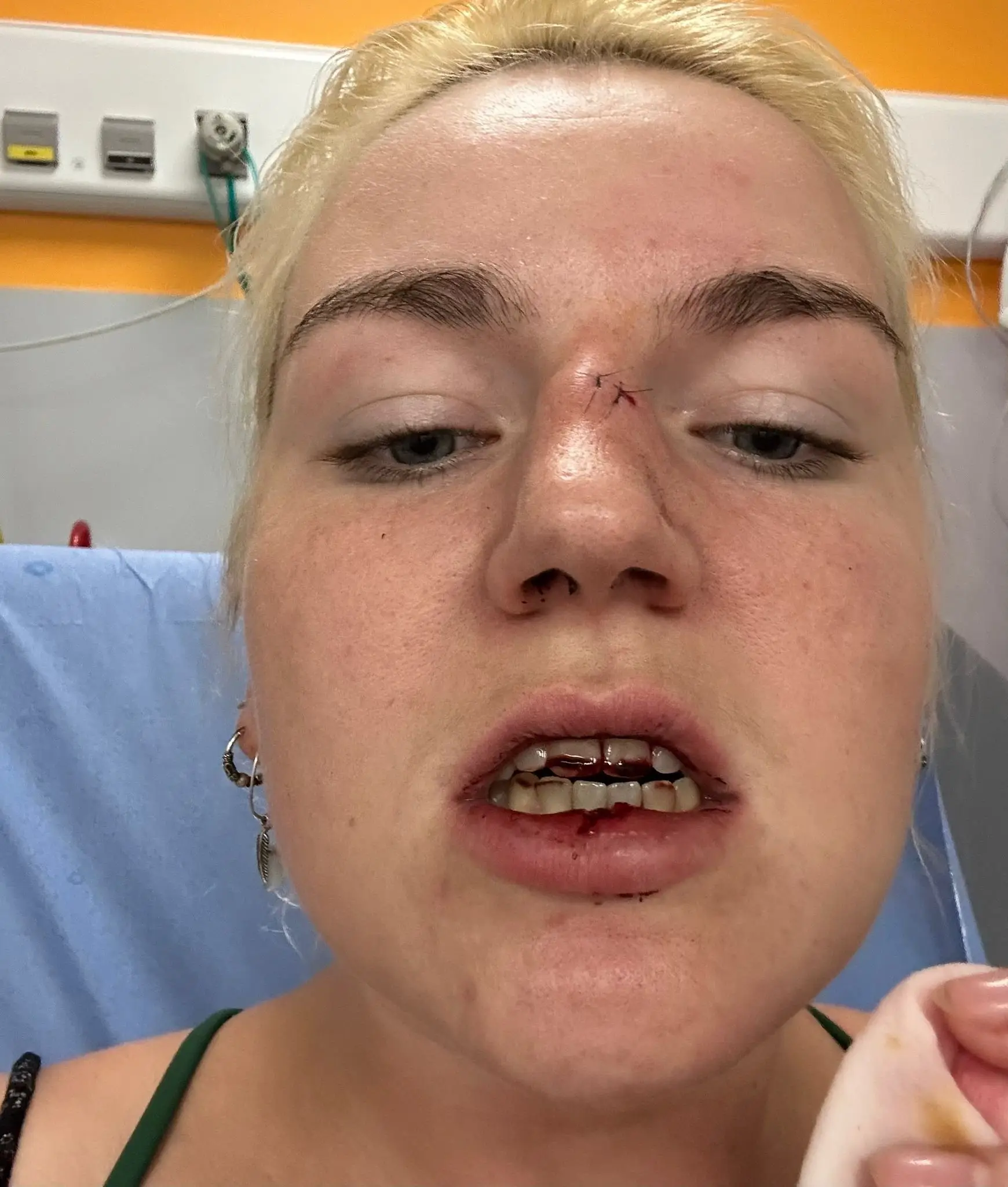 It's not the best look (SWNS)