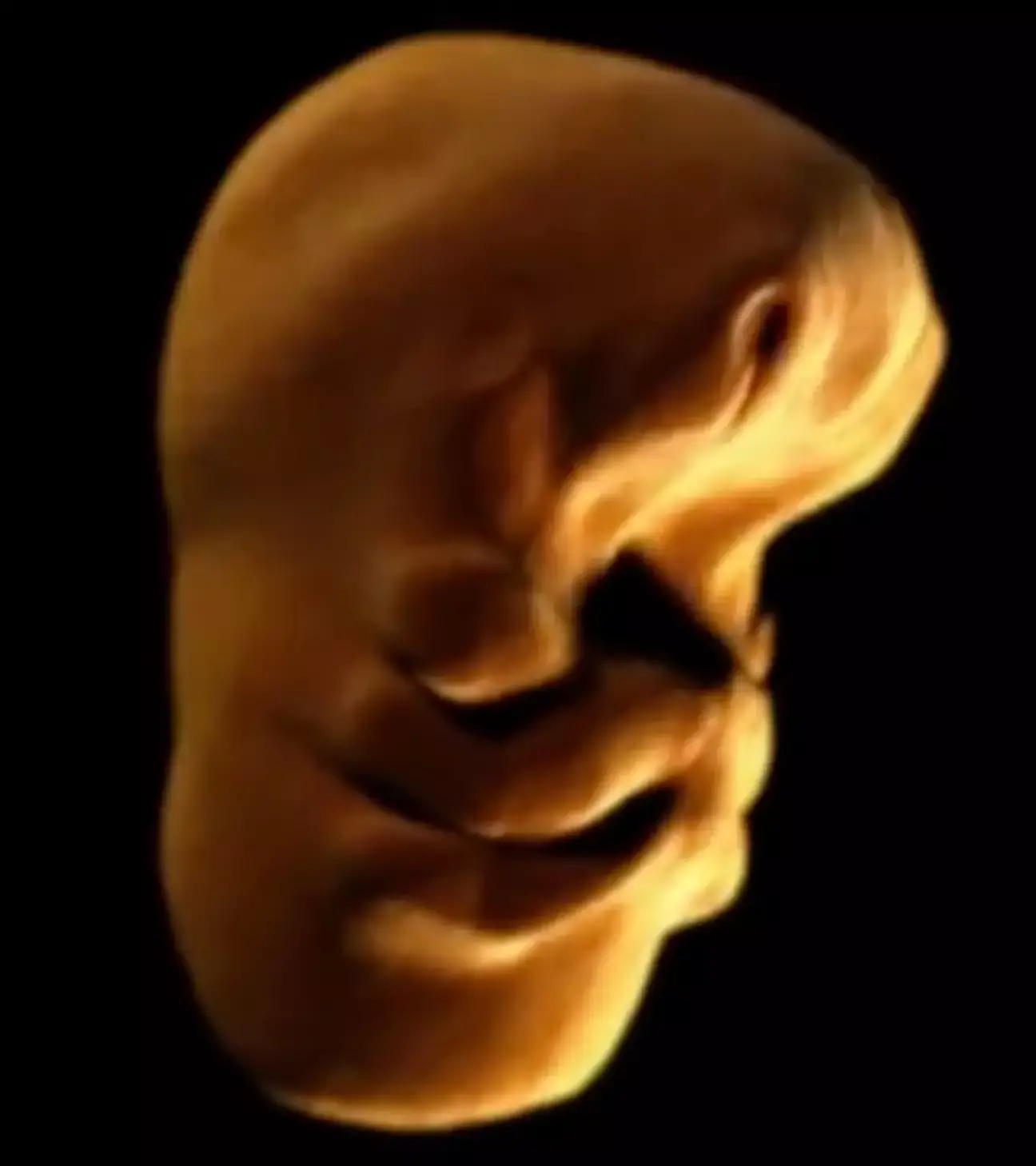 The face is initially unrecognisable.