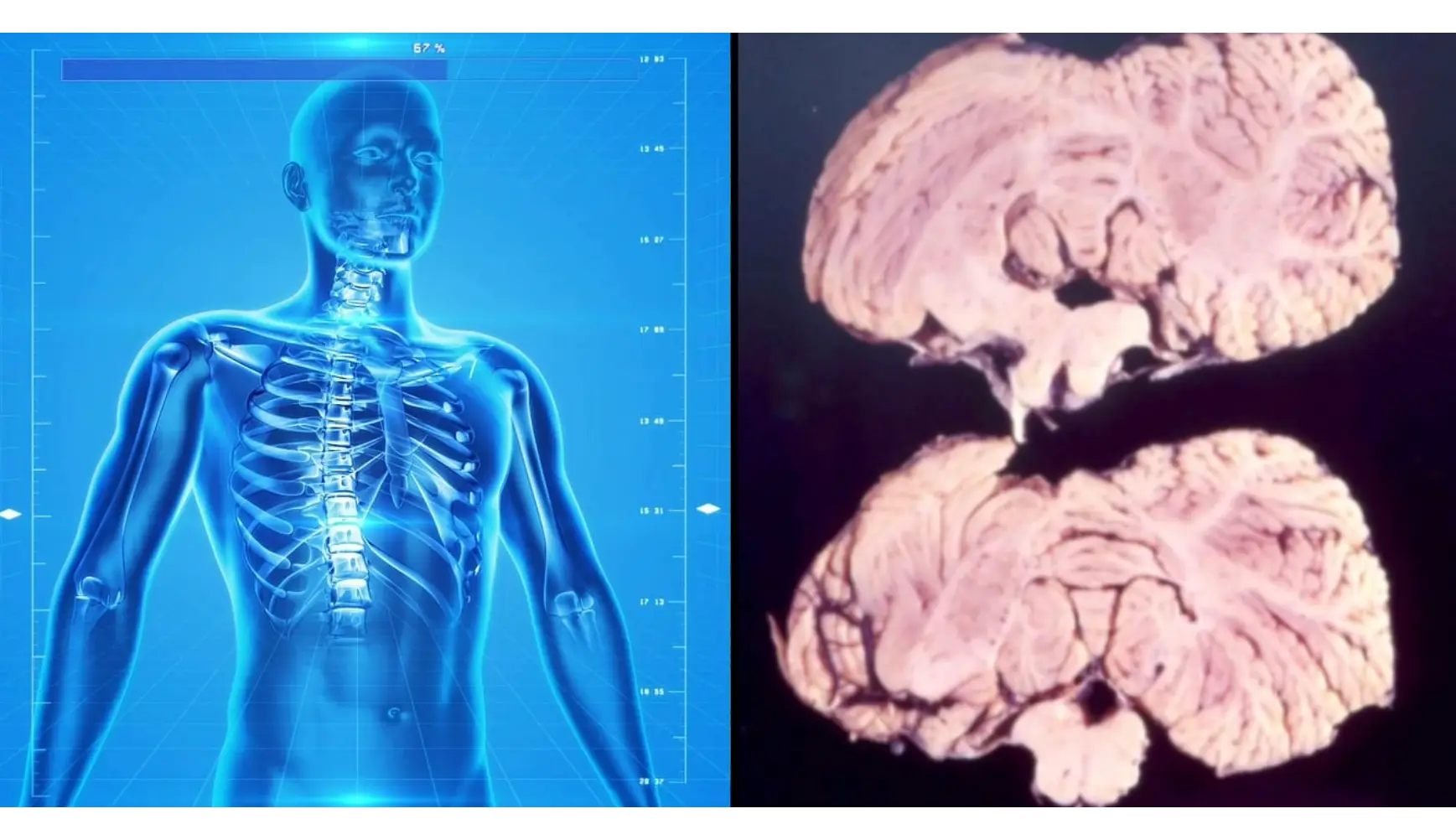 Wikipedia Commons / Pixabay