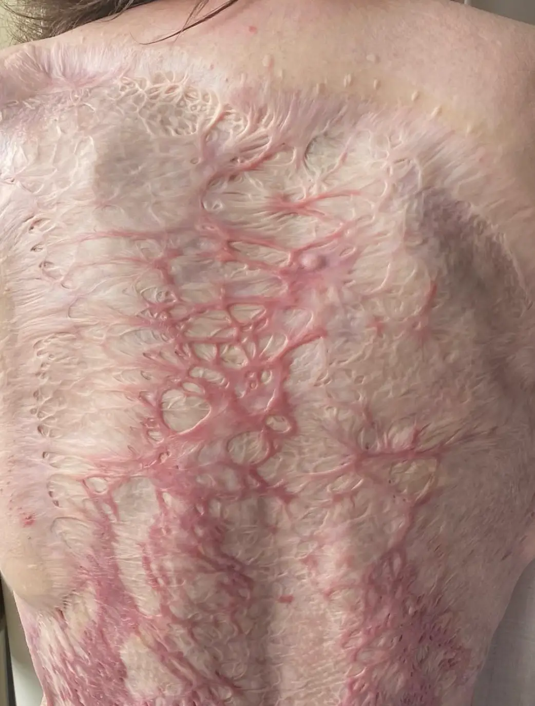 She now lives with scars from that devastating day (Instagram/@stephaniecoral96)