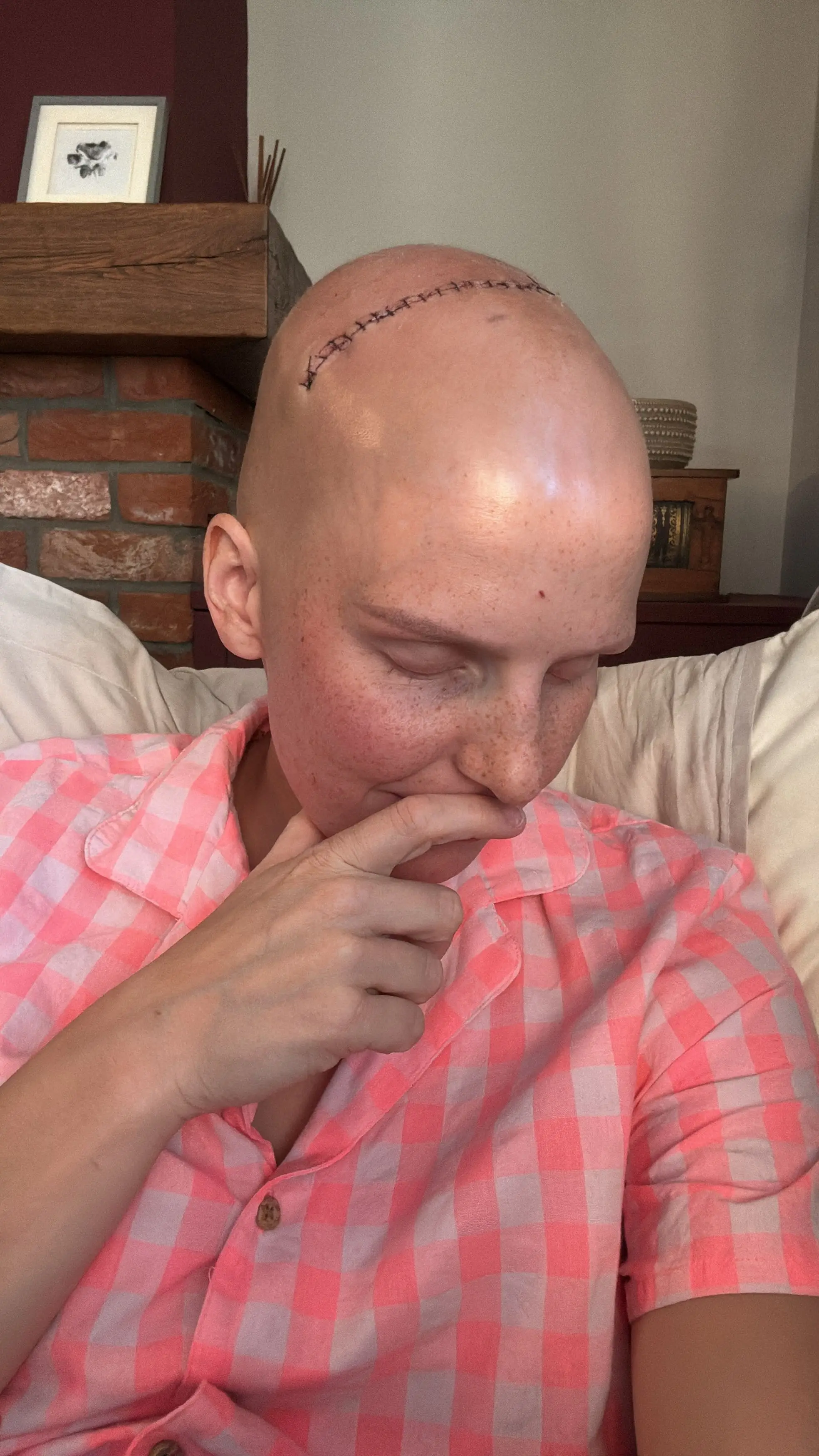 Alice is currently recovering from emergency brain surgery (Kennedy News and Media)