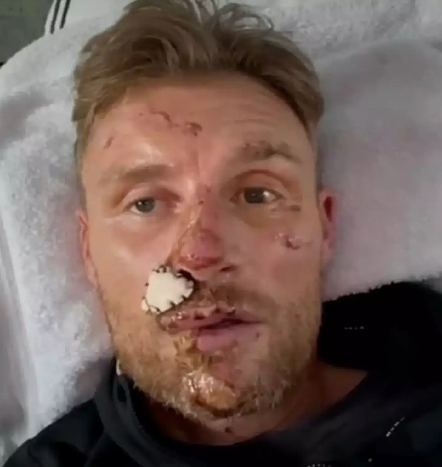 Flintoff's surgeon says his injuries were among the most extensive he'd seen (BBC)