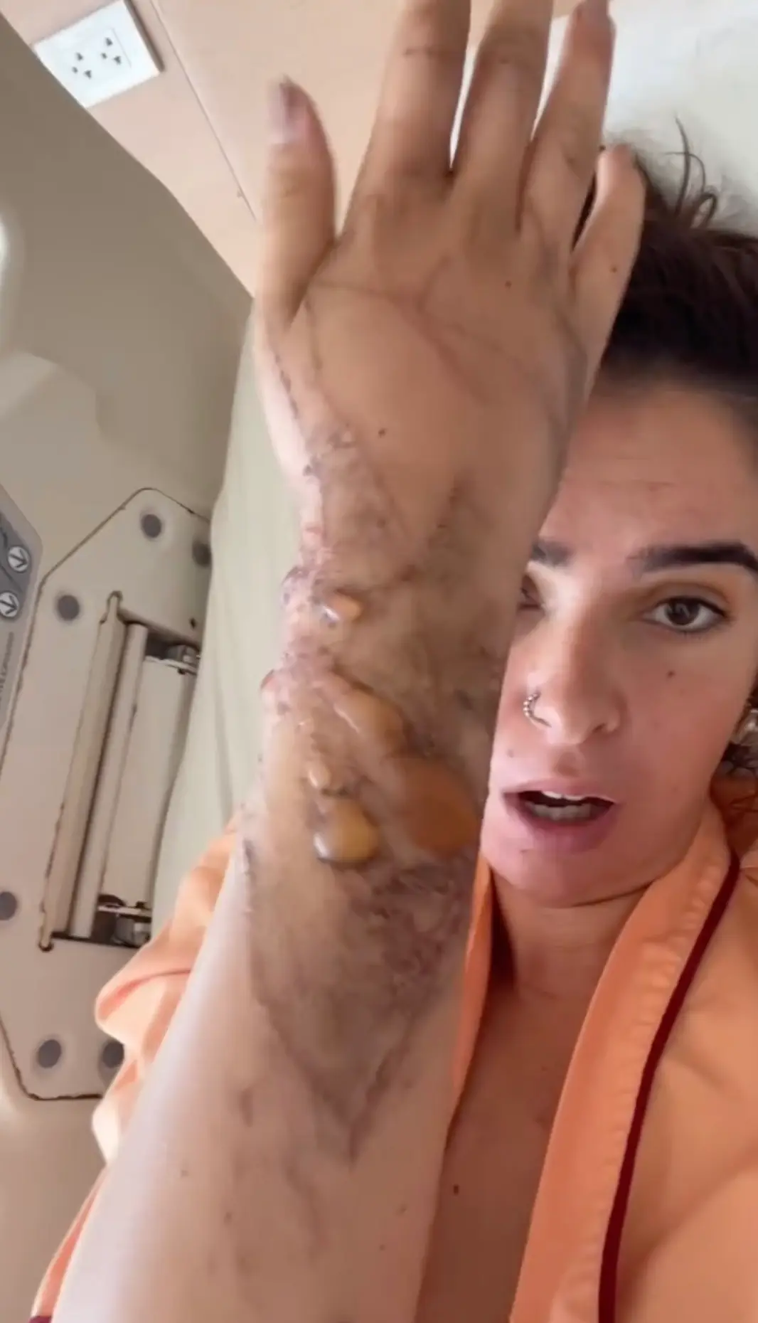 Zoe Cahill miraculously survived her brush with a deadly box jellyfish in Thailand (Instagram/@zoe_cahill)