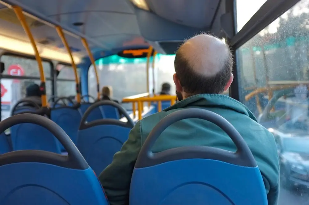 Baldness impacts millions of people worldwide.