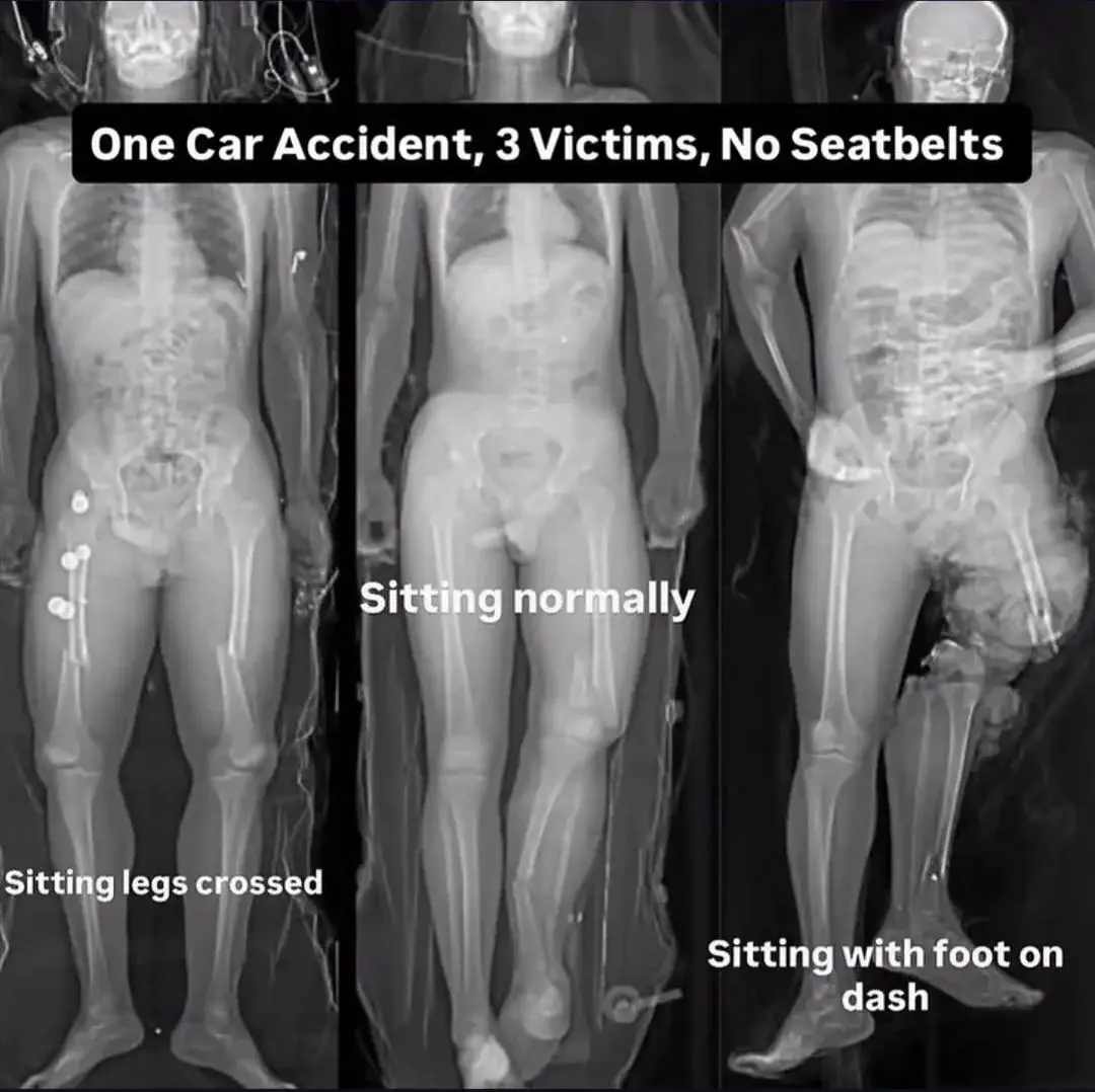 That's me never putting a foot on the dashboard ever again (Reddit)