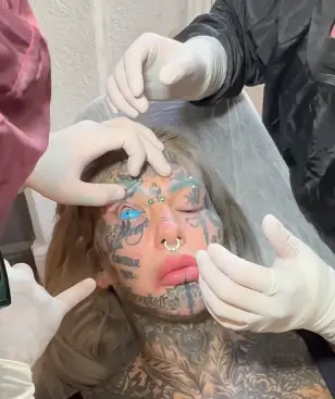 Amber was having her eyeballs tattoed (Amberluke.666/Instagram)